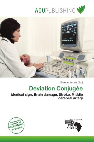 Deviation Conjugée