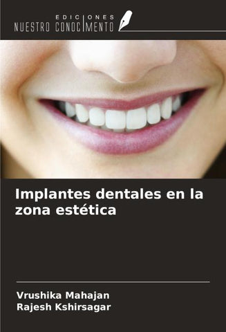Implantes dentales en la zona estética