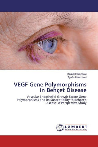 VEGF Gene Polymorphisms in Behçet Disease