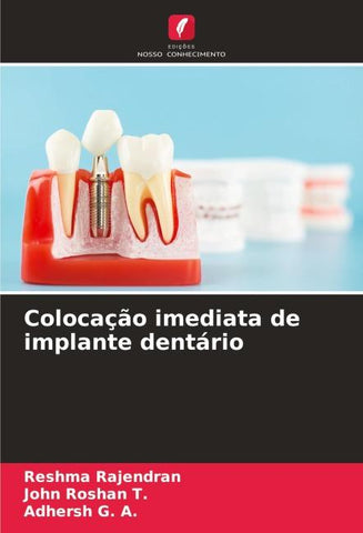 Colocação imediata de implante dentário