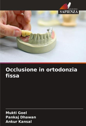 Occlusione in ortodonzia fissa