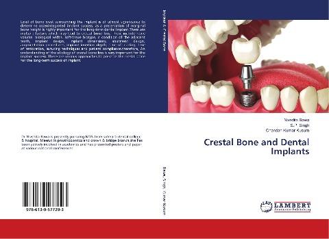 Crestal Bone and Dental Implants