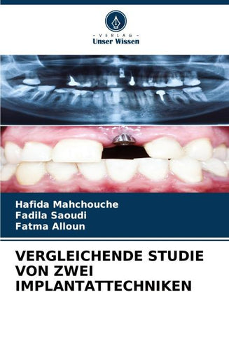 VERGLEICHENDE STUDIE VON ZWEI IMPLANTATTECHNIKEN