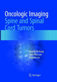 Oncologic Imaging: Spine and Spinal Cord Tumors
