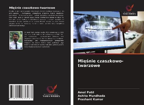 Mi¿¿nie czaszkowo-twarzowe