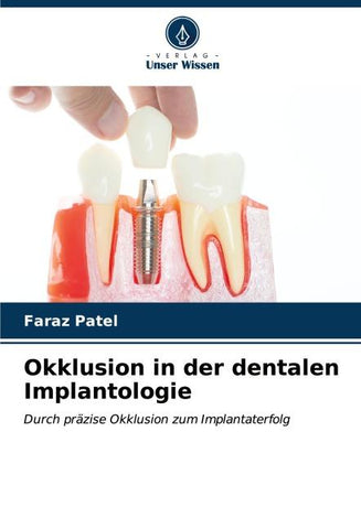 Okklusion in der dentalen Implantologie