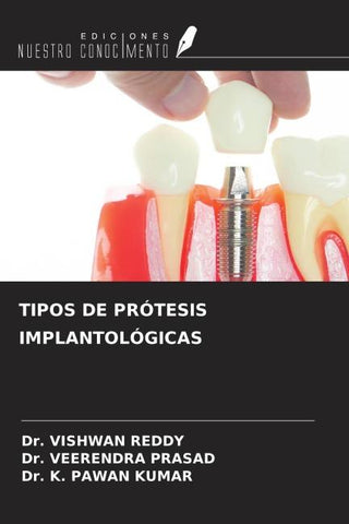 TIPOS DE PRÓTESIS IMPLANTOLÓGICAS