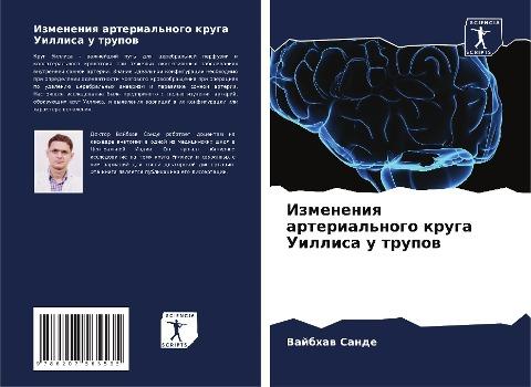 Izmeneniq arterial'nogo kruga Uillisa u trupow