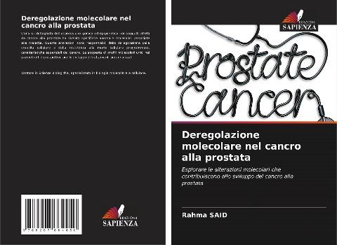 Deregolazione molecolare nel cancro alla prostata