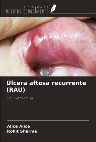 Úlcera aftosa recurrente (RAU)