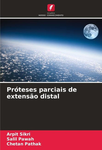 Próteses parciais de extensão distal