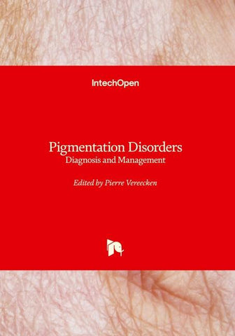 Pigmentation Disorders - Diagnosis and Management
