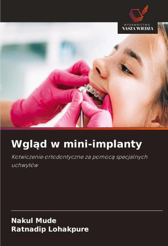 Wgl¿d w mini-implanty