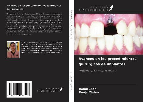 Avances en los procedimientos quirúrgicos de implantes
