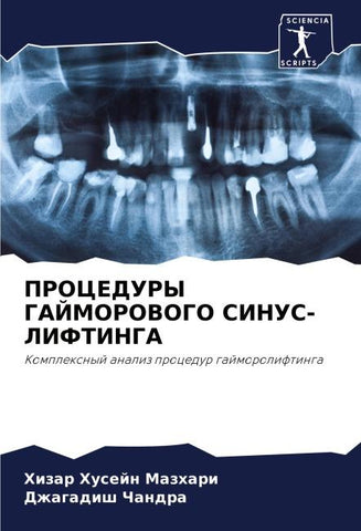 PROCEDURY GAJMOROVOGO SINUS-LIFTINGA