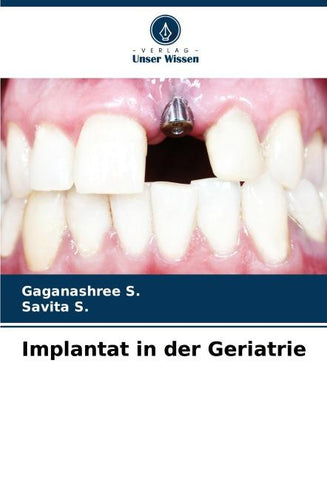 Implantat in der Geriatrie