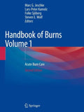 Handbook of Burns Volume 1