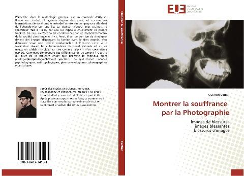 Montrer la souffrance par la Photographie