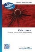 Colon cancer