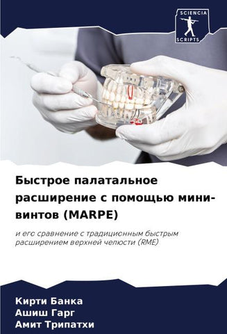 Bystroe palatal'noe rasshirenie s pomosch'ü mini-wintow (MARPE)