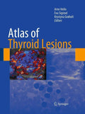 Atlas of Thyroid Lesions
