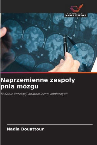 Naprzemienne zespo¿y pnia mózgu