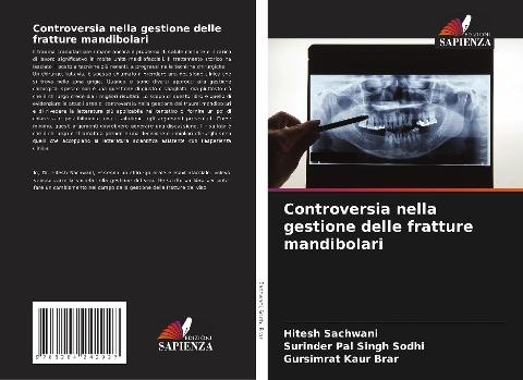 Controversia nella gestione delle fratture mandibolari
