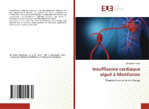 Insuffisance cardiaque aiguë à Montlucon