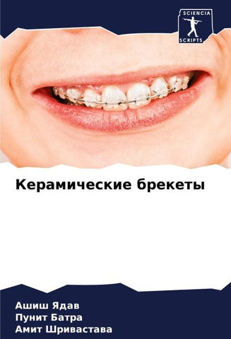 Keramicheskie brekety