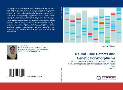 Neural Tube Defects and Genetic Polymorphisms