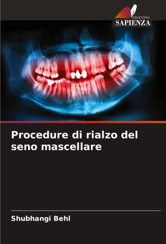 Procedure di rialzo del seno mascellare