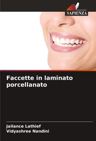 Faccette in laminato porcellanato