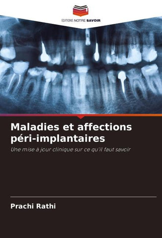 Maladies et affections péri-implantaires