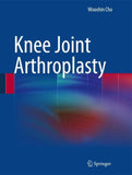 Knee Joint Arthroplasty