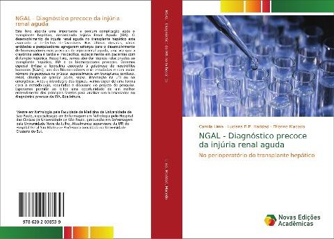 NGAL - Diagnóstico precoce da injúria renal aguda