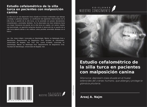 Estudio cefalométrico de la silla turca en pacientes con malposición canina