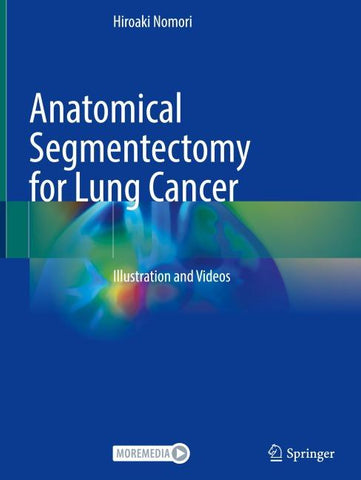 Anatomical Segmentectomy for Lung Cancer