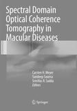 Spectral Domain Optical Coherence Tomography in Macular Diseases