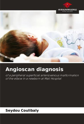 Angioscan diagnosis