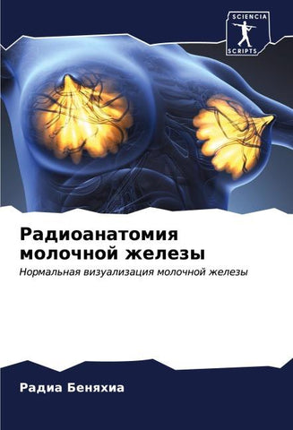 Radioanatomiq molochnoj zhelezy