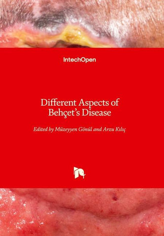 Different Aspects of Behçet's Disease