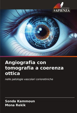 Angiografia con tomografia a coerenza ottica