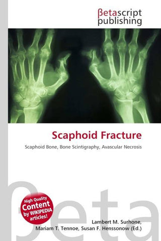 Scaphoid Fracture
