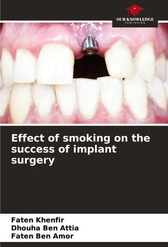 Effect of smoking on the success of implant surgery