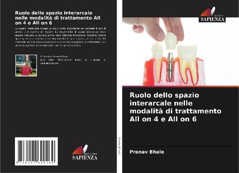 Ruolo dello spazio interarcale nelle modalità di trattamento All on 4 e All on 6