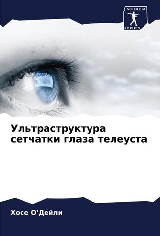 Ul'trastruktura setchatki glaza teleusta