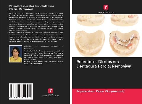 Retentores Diretos em Dentadura Parcial Removível