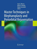 Master Techniques in Blepharoplasty and Periorbital Rejuvenation