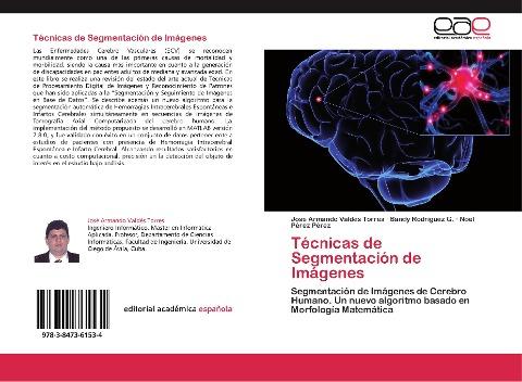 Técnicas de Segmentación de Imágenes