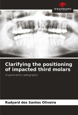 Clarifying the positioning of impacted third molars